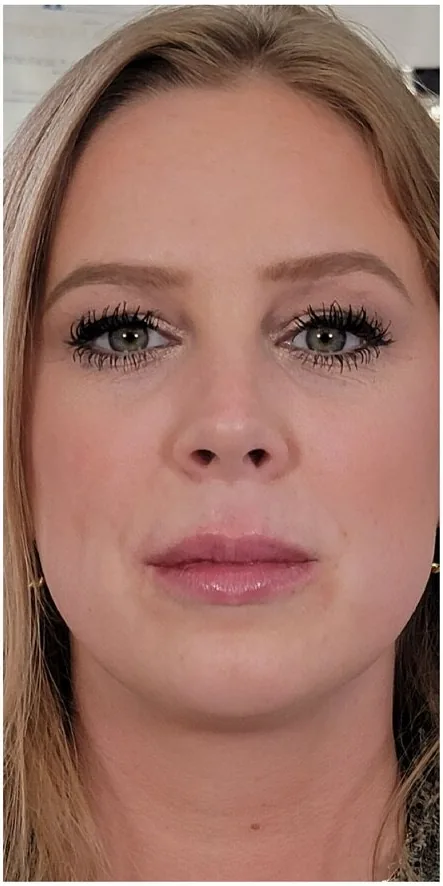Lasers & light at Petro Facial Plastic Surgery & Medspa