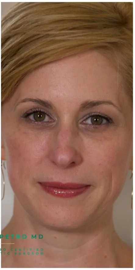 Skin at Petro Facial Plastic Surgery & Medspa